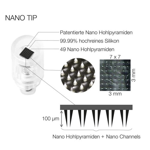 Kosmetikinstitut Susann Muth - Nano Tip